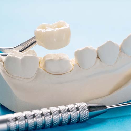 Zirconium crowns