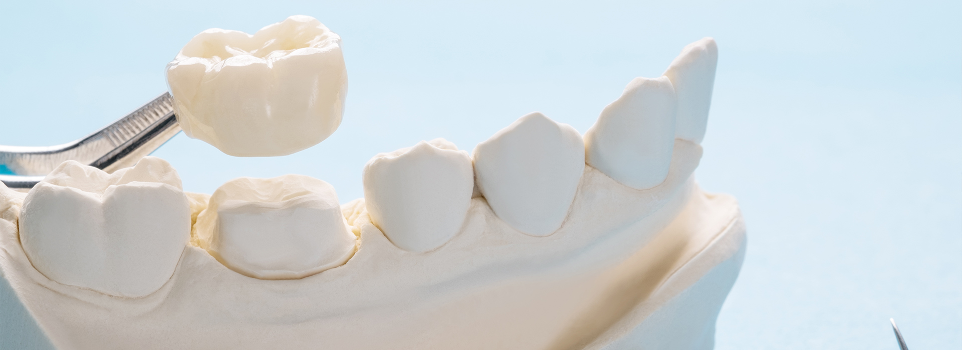 Zirconium crowns