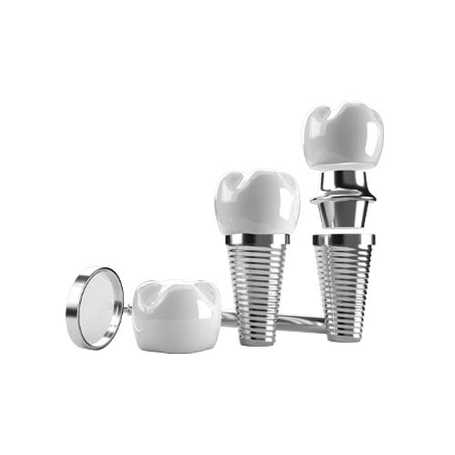 Dental implants