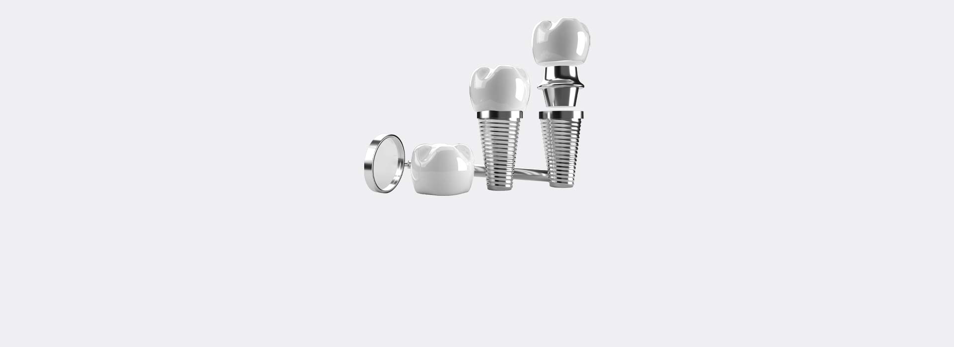 Dental implants